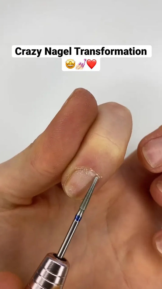 Nagelhaut entfernen
