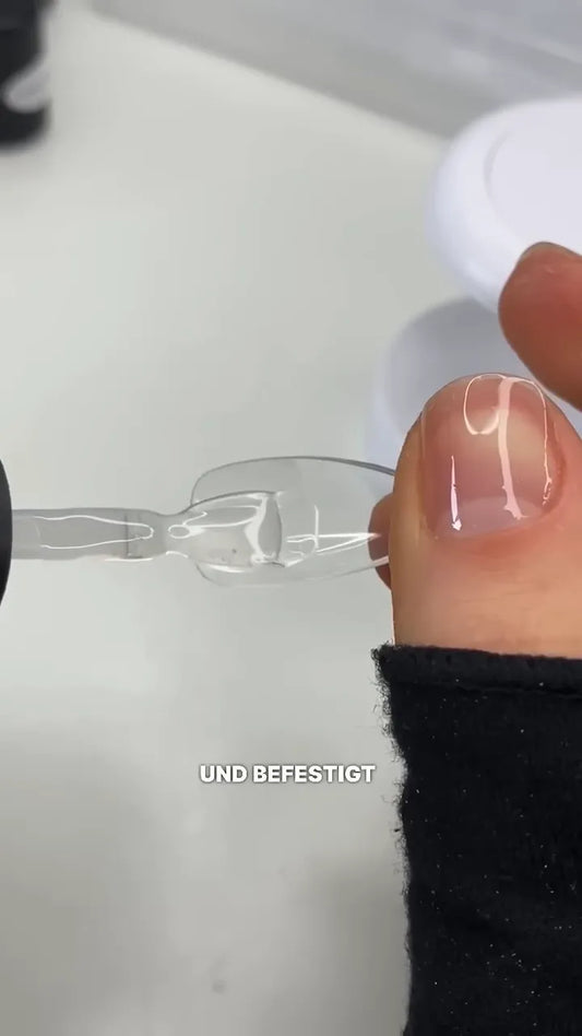 Helix Methode mit Softgits und Gel