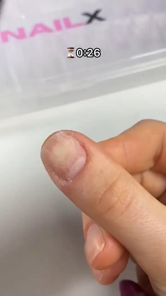 Nagelvorbereitung: Nagelhaut zurückschieben und Nägel anrauen